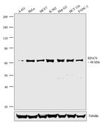 RPA70 Antibody in Western Blot (WB)