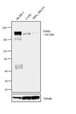ErbB2 (HER-2) Antibody in Western Blot (WB)