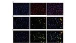 Adenosine Kinase Antibody in Immunohistochemistry (IHC)