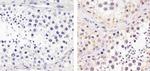 Cdc25C Antibody in Immunohistochemistry (Paraffin) (IHC (P))