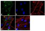 MMP3 Antibody in Immunocytochemistry (ICC/IF)