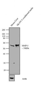 MMP3 Antibody in Western Blot (WB)