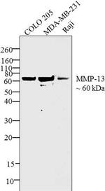 MMP13 Antibody in Western Blot (WB)