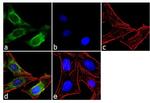 MMP13 Antibody in Immunocytochemistry (ICC/IF)