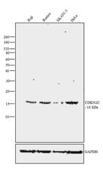 CDKN2C Antibody in Western Blot (WB)