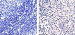 E2F1 Antibody in Immunohistochemistry (Paraffin) (IHC (P))
