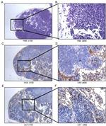 Cytokeratin 8 Antibody in Immunohistochemistry (IHC)