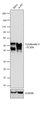 Cytokeratin 8 Antibody in Western Blot (WB)