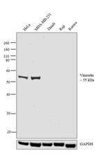 Vimentin Antibody