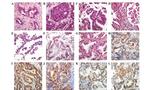 E-cadherin Antibody in Immunohistochemistry (Paraffin) (IHC (P))
