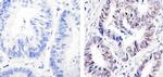 p53 Antibody in Immunohistochemistry (Paraffin) (IHC (P))