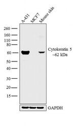 Cytokeratin 5 Antibody