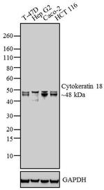Cytokeratin 18 Antibody in Western Blot (WB)