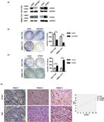 Ki-67 Antibody in Immunohistochemistry (IHC)
