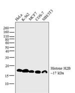 Histone H2B Monoclonal Antibody (C.362.2)