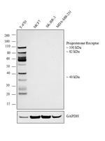 Progesterone Receptor Antibody in Western Blot (WB)