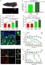 NEFL Antibody in Immunocytochemistry (ICC/IF)