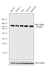 IRE1 alpha Monoclonal Antibody (J.607.10)