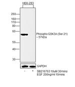 Phospho-GSK3 alpha (Ser21) Monoclonal Antibody (R.726.2)