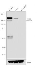ErbB2 (HER-2) Monoclonal Antibody (K.929.9)
