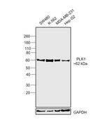 PLK1 Monoclonal Antibody (E.456.6)