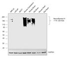 Neurofilaments 70/200 kDa Antibody in Western Blot (WB)