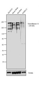 Neurofilaments 70/200 kDa Antibody in Western Blot (WB)