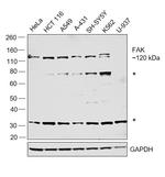 FAK Monoclonal Antibody (4A9D6)