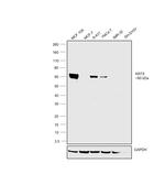 Cytokeratin 5 Antibody in Western Blot (WB)