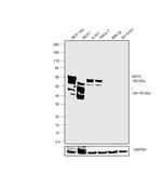 Cytokeratin 5 Antibody in Western Blot (WB)