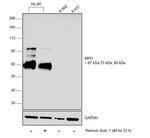 Myeloperoxidase Monoclonal Antibody (9B12G7,4D8B12,9B12D9,9C11A5)