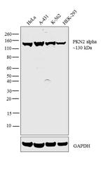 PKN2 Antibody in Western Blot (WB)