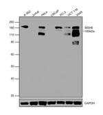 MSH6 Monoclonal Antibody (5B11)