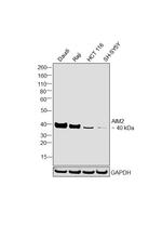 AIM2 Monoclonal Antibody (10M2B3)