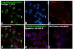 Progesterone Receptor Antibody