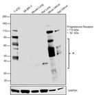 Progesterone Receptor Antibody
