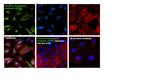 Vimentin Monoclonal Antibody (SP20)