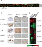 p16INK4a Antibody in Immunohistochemistry (Paraffin) (IHC (P))
