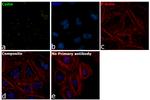 Coilin Antibody in Immunocytochemistry (ICC/IF)