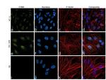 CYBA Monoclonal Antibody (CS9)
