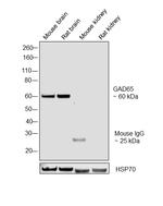 GAD65 Monoclonal Antibody (144)