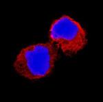IL-1 beta Monoclonal Antibody (2805)