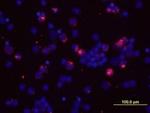 IL-2 Antibody in Immunocytochemistry (ICC/IF)