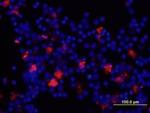 IL-8 (CXCL8) Antibody in Immunocytochemistry (ICC/IF)