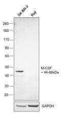 M-CSF Monoclonal Antibody (21113)