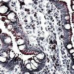 MCP-1 Antibody in Immunohistochemistry (Paraffin) (IHC (P))