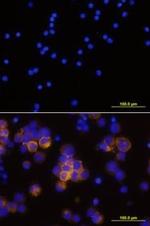 CD25 Antibody in Immunocytochemistry (ICC/IF)