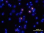 TNF alpha Monoclonal Antibody (28401)