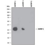 IGFBP-1 Monoclonal Antibody (33627)