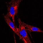 TIMP1 Antibody in Immunocytochemistry (ICC/IF)